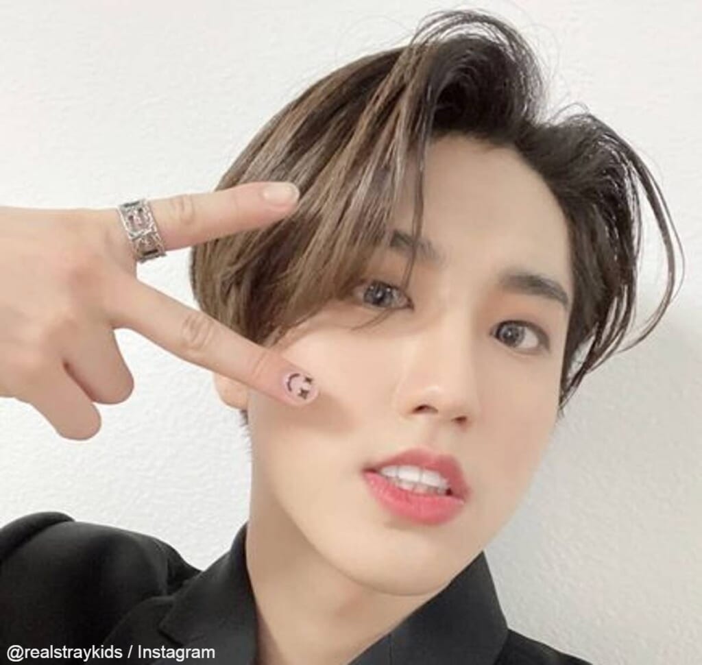 Stray Kids ハン、まるでハリー・ポッター! おでこの傷について衝撃の事実を語る! 活発すぎて2度も病院行き・・ 幼少期のわんぱく ...